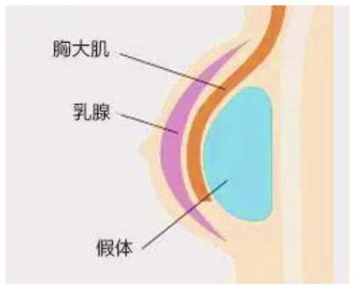 米蘭柏羽開(kāi)啟胸部醫(yī)生面診日，穆大力、李英大親診做出精致自然美胸