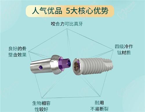 北京科爾口腔嚴(yán)選免費(fèi)種植牙優(yōu)勢(shì)