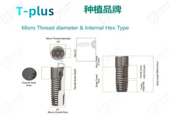 瑞士T-plus種植體