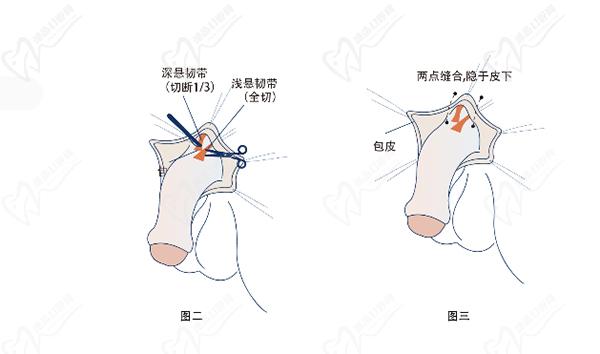 重慶星榮整形醫(yī)院李世榮預(yù)約掛號(hào)時(shí)間