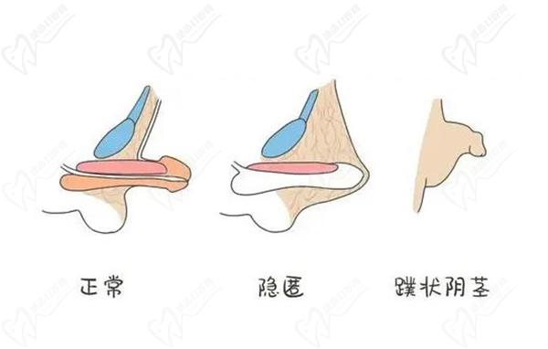 24小時(shí)男科在線咨詢平臺(tái)在線問(wèn)診