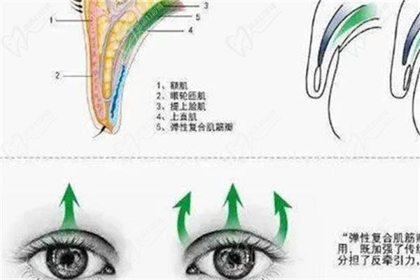 佀同帥擅長(zhǎng)哪種雙眼皮