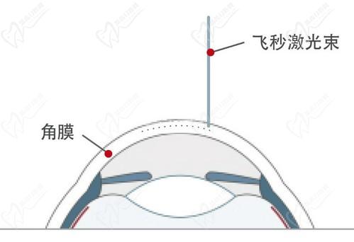 王曉瑛醫(yī)生在哪里出診？上海普瑞、上海和平等眼科醫(yī)院可預(yù)約